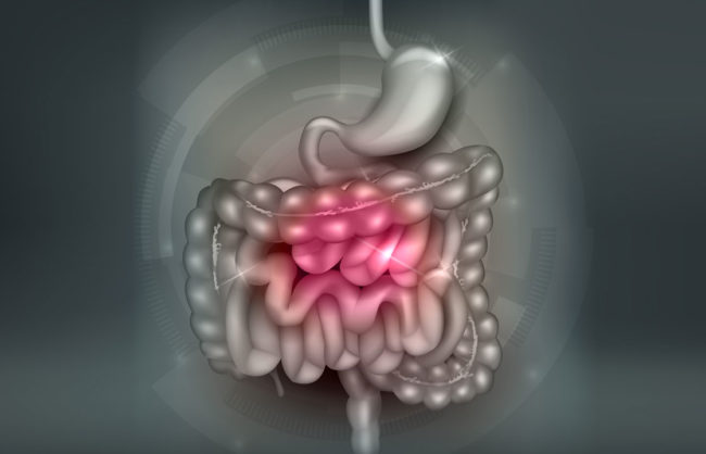 Reizdarm – reine Nervensache? Erfahren Sie hier alles über das Reizdarmsyndrom und Therapieansätze.