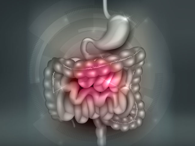 Erfahren Sie hier alles über das Reizdarmsyndrom und Therapieansätze.