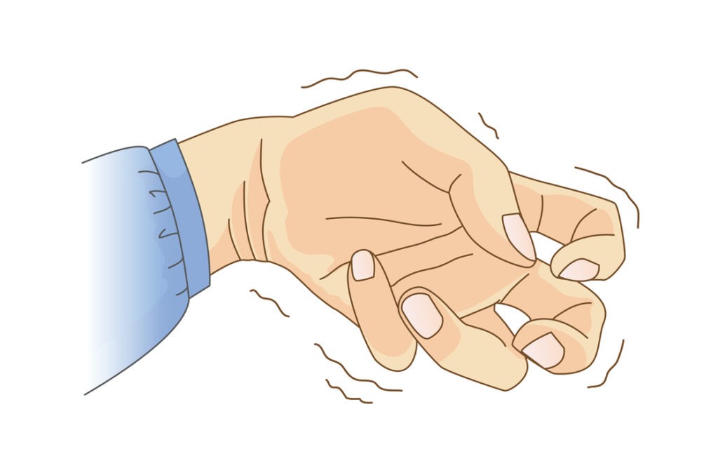 Das typische Morbus Parkinson Symptom - Händezittern.