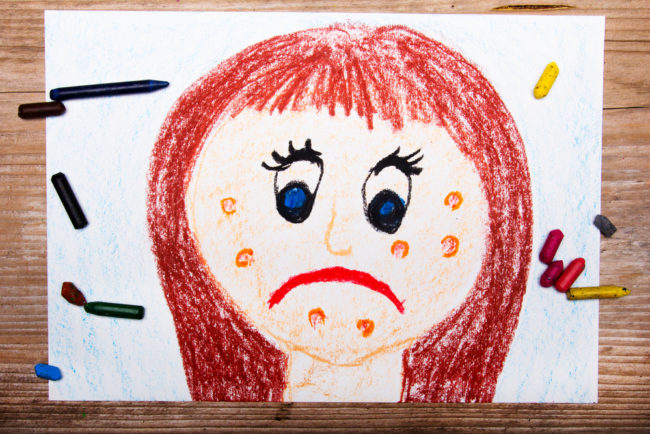 Colorful,Drawing:,Sad,Young,Woman,With,Acne