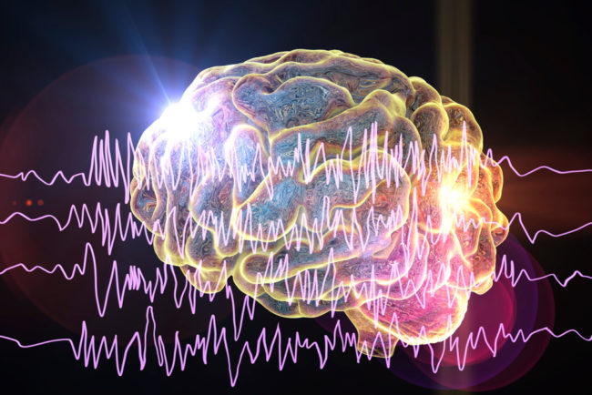 Epilepsy,Awareness,Concept.,Brain,And,Encephalography,In,Epilepsy,Patient,During