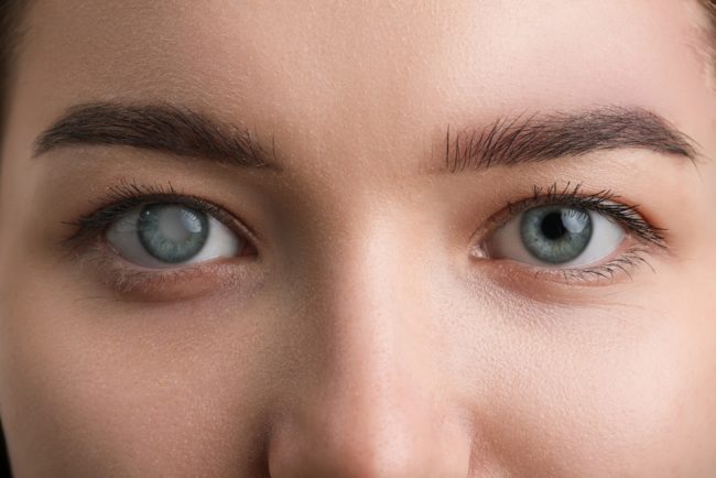 Closeup,View,Of,Woman,Before,And,After,Glaucoma,Treatment